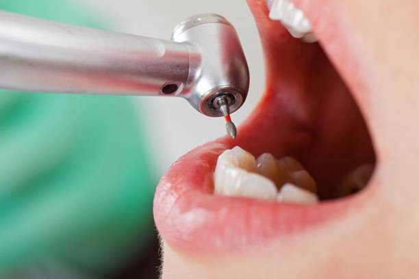 Best Emergency Treatment for Dental Infections or Abscesses in Lansing, KS